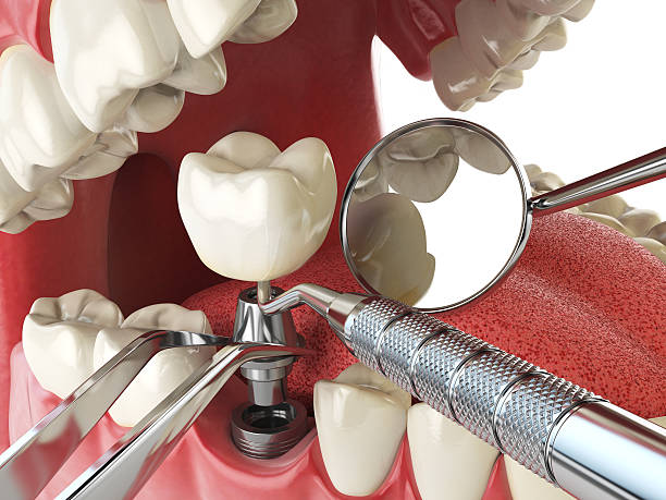 Best Emergency Dental Services for Seniors in Airy Heights, WA